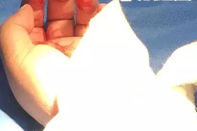 南京摔狗者妻子“割腕”获救出院 被建议看心理医生