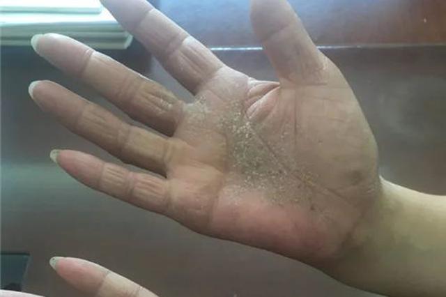 一个吸毒者的自白：从胳膊到指尖布满了黑线