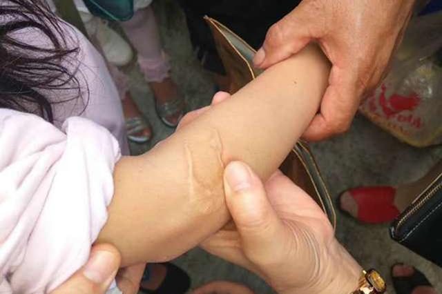 四年级女孩遭继母虐待 父亲不让曝光：担心失去老婆