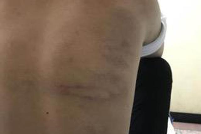 河北一初中生被同学打折肋骨 校长自责：我监管不力