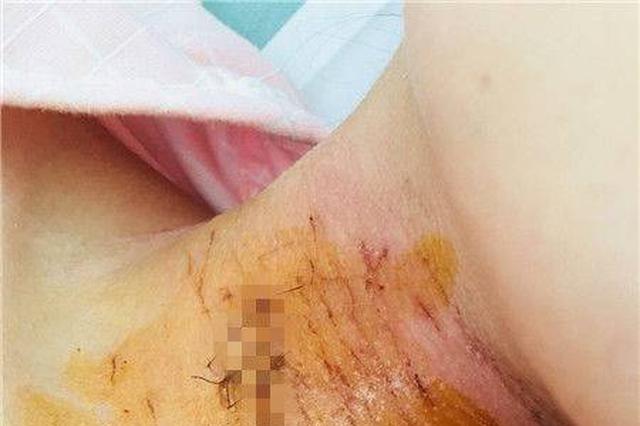 女孩遭13岁男同学刺伤未立案 专家建议降低刑责年龄