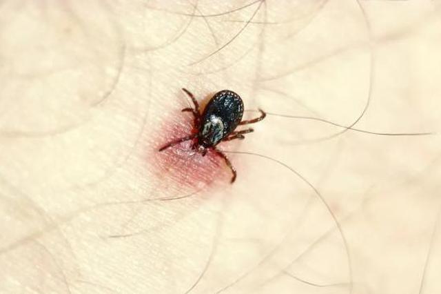 因被黑色蜱虫叮咬致病 盱眙一家两人相继去世