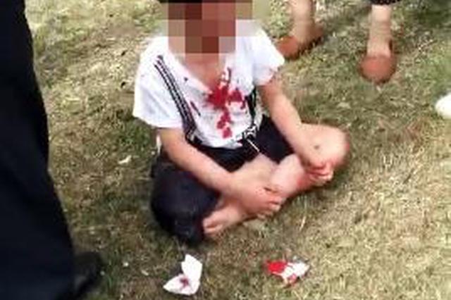 万幸！六岁男童七楼坠落侥幸生还，多亏了它们