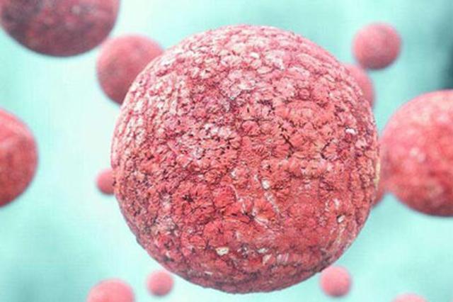 肿瘤转移及复发有望被抑制 苏大提出治疗新方案