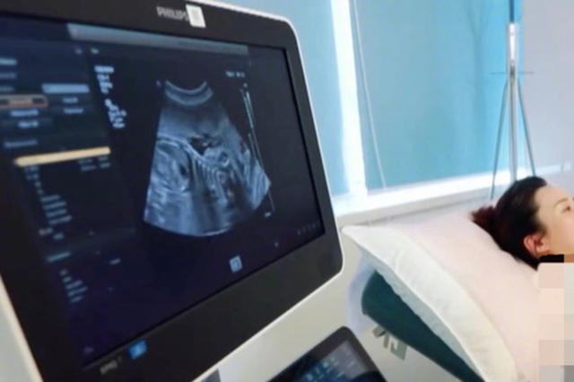 出生缺陷发生率上升 2018年江苏产前将筛查70万人