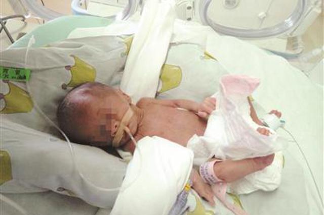 南京“坚强宝宝”闯过关卡健康出院