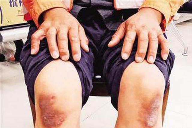 机场装卸工的夏天：日装10吨货 膝盖“烫”出茧疤