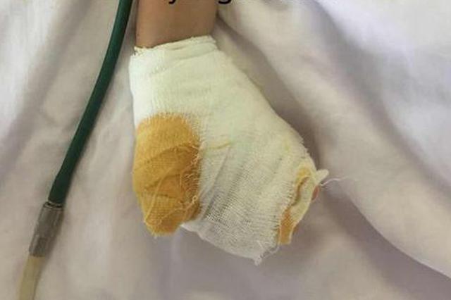 把金属饭叉插入接线板 两岁女童被电流击飞