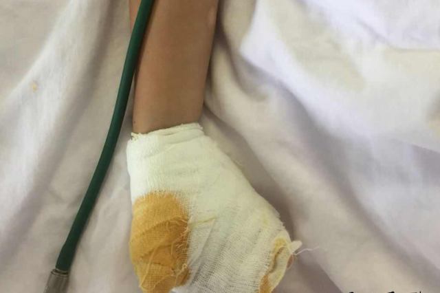 当心！把金属饭叉插入接线板 淮安一两岁女童被“电飞”