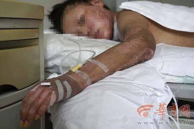 18岁女孩美容院打工被烧伤 涉事公司：不可能出钱