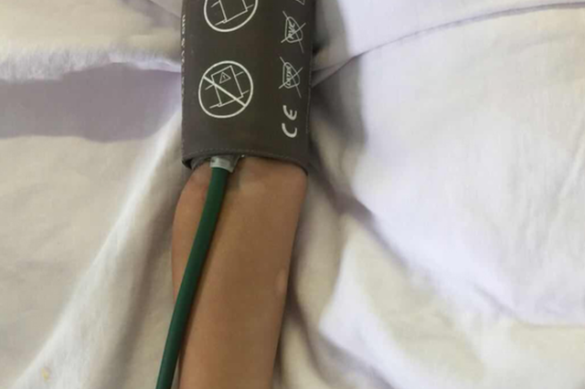 淮安2岁女童将金属饭叉插入接线板 被“电飞”