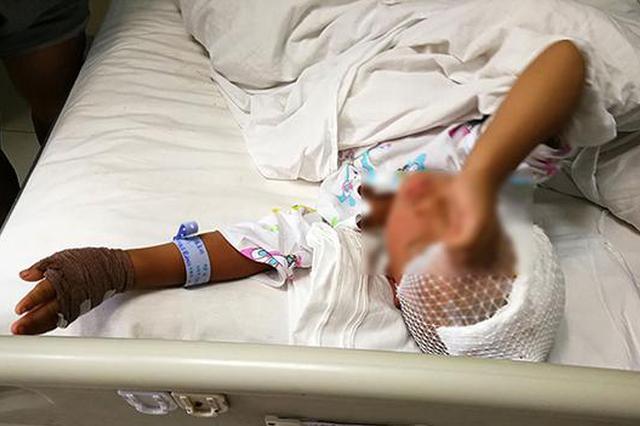 4岁小女孩被邻居大狗咬掉头皮 家中靠低保生活