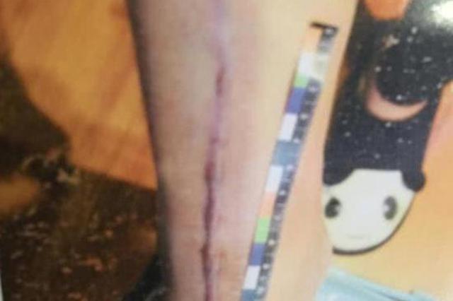 17岁女生不堪同学侮辱殴打跳楼摔残 6名学生被判担七成责