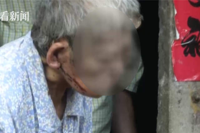 8旬老人遭孙子打伤血流不止未被送医:被怀疑偷钱