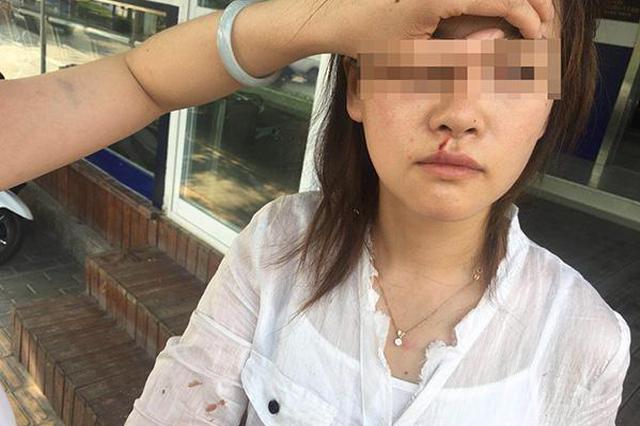 江苏游客赴西安探亲 坐滴滴快车全家被打伤(图)