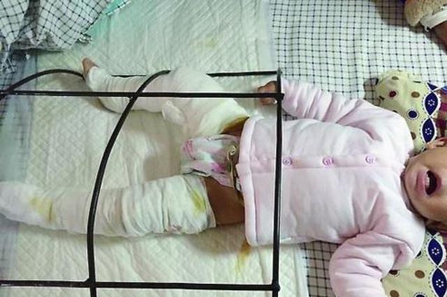 滚水从天而降烫伤女童 肇事者和雇主全责被判赔52万元