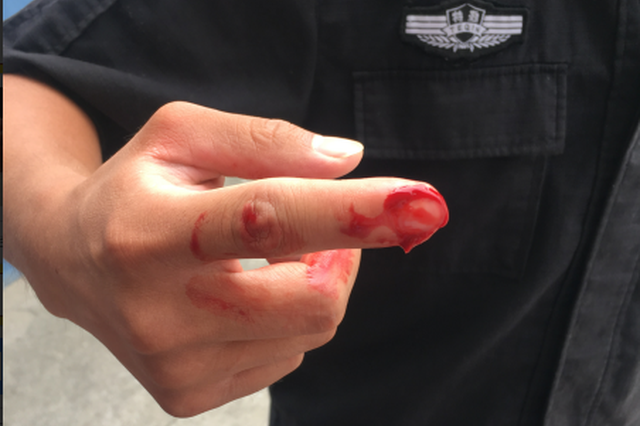 骑车撞了人还不服管 他张牙伤2人舞爪伤1人