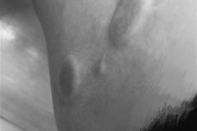 购买元祖雪月饼却被干冰冻伤 女顾客获赔1000元