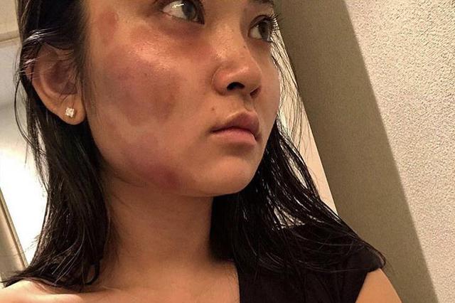 四川广安女副区长遭家暴致死 男友被判无期