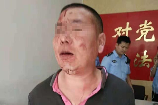 徐州丰县城管殴打个体户致多处骨折 2人获缓刑2人被管制