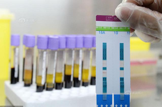 医院失误疑致病人感染HIV等 逾三千人被要求检测