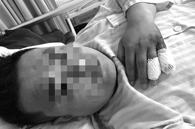 嘀嗒顺风车司机加价被拒砍人 乘客手指被砍断