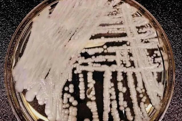 超级真菌大爆发?专家:健康人群不会感染无需恐慌