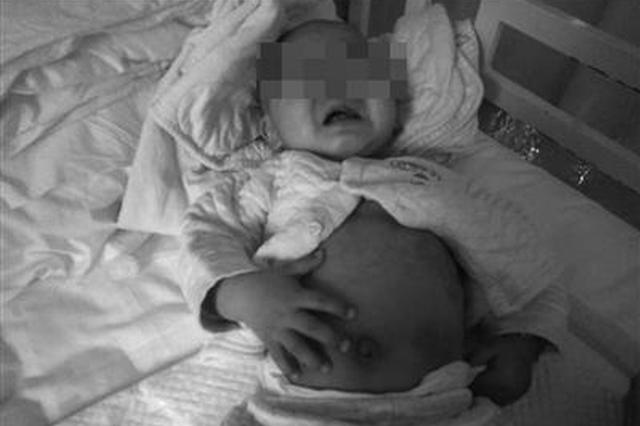 2岁娃术后禁食半个月 太饿竟将手指咬得鲜血直流……