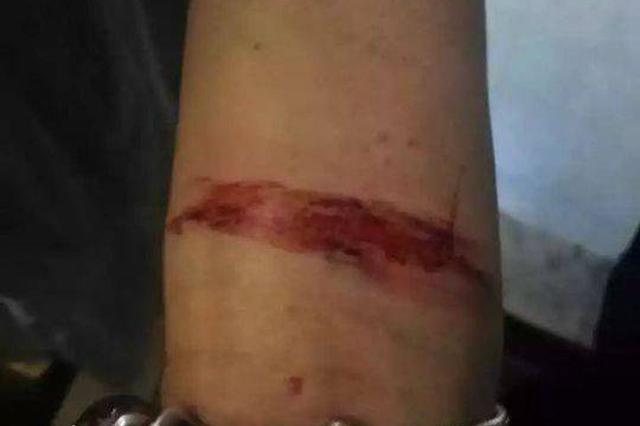 冲动割腕发朋友圈 民警物业联合搜救