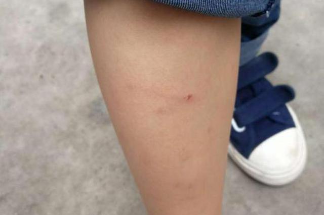 6岁男孩被街坊狗咬两次 男孩父亲打死狗遭索赔2万