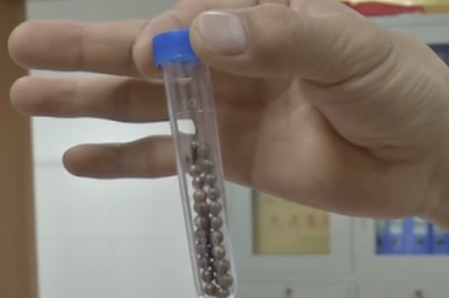 13岁男孩往尿道内塞29颗磁力珠 强忍3个月才就医