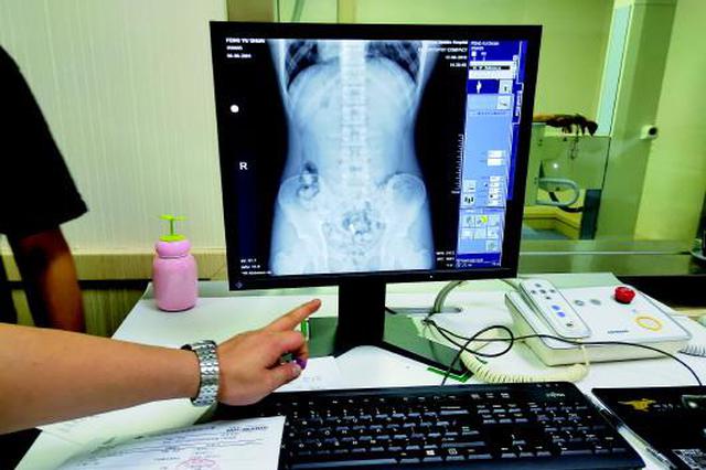 起底人体贩毒产业:花季少年何以沦为贩毒“骡子”