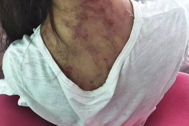 男童被母亲虐打？警方：因学习问题殴打 不能影响四邻