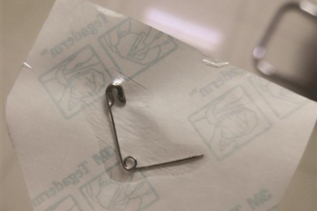 只因母亲一个动作 三岁女童把别针吞进肚里(图)