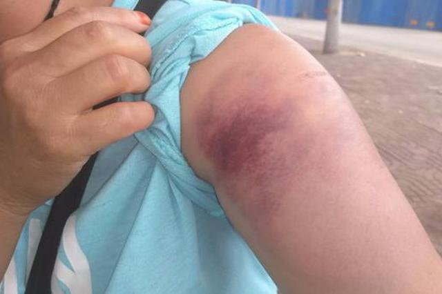 义马气化厂爆炸前车间冒出白烟 两个月前刚刚停产大检