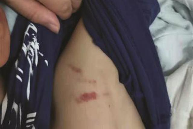 8岁男童泳池内被3次抱摔 这段15秒的视频看怒多少家长