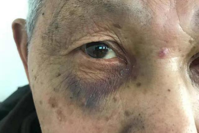 老人娶保姆过户完房产被家暴 保姆拒还房屋玩失踪