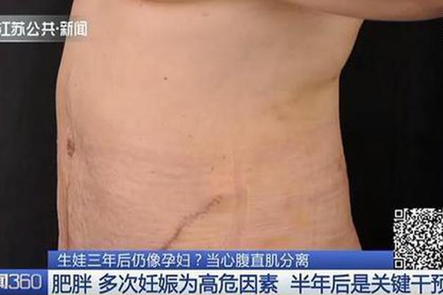 二胎妈妈坚持健身肚子竟越减越大 生娃三年后仍像孕妇