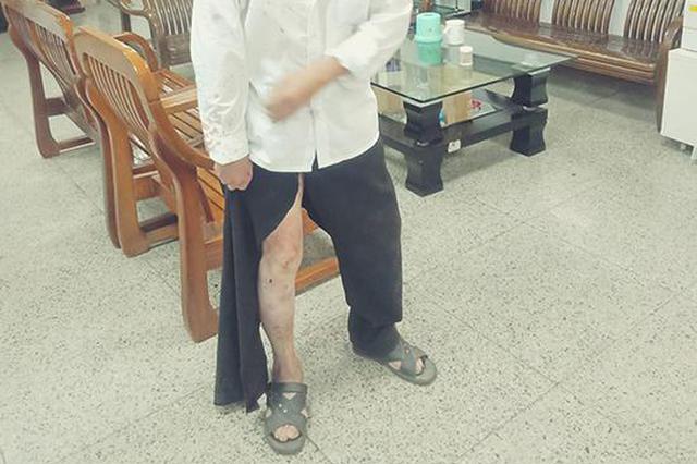 残疾男子遭妻子家暴被打伤下体 曾获人身保护令