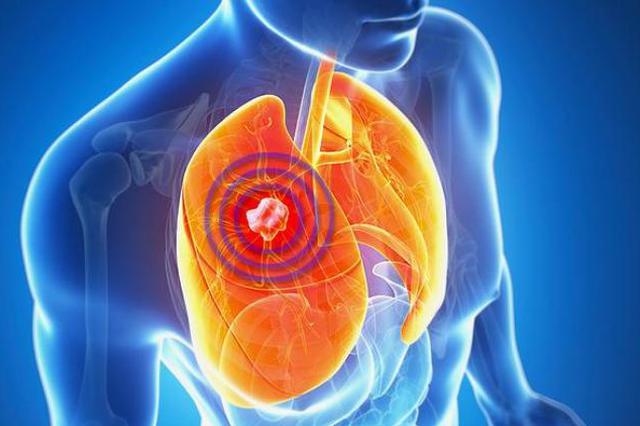 武大人民医院：发热咳嗽并非新冠肺炎的唯一首发症状