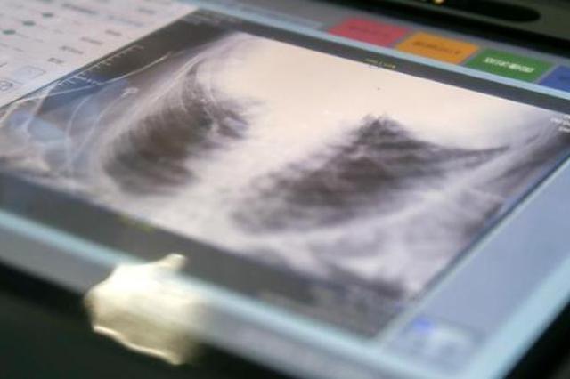 新型冠状病毒肺炎确诊病例为何急剧增长？白岩松连线专家答疑