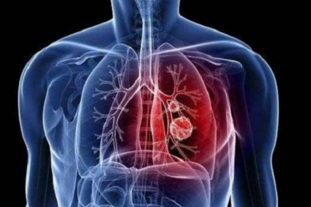 柳叶刀披露首例新冠肺炎患者发病日期，较官方通报早7天