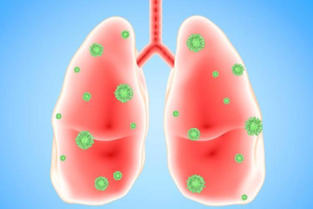 湖北新增1032例新型冠状病毒感染的肺炎病例 累计4586例