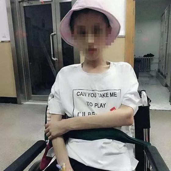 21岁女孩减肥至50斤 2次脑出血脑组织如60岁