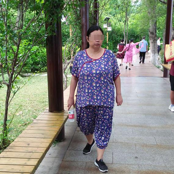 孕妇剖宫引产4个月后死亡：小肠腔现3块来源不明纱布