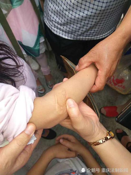 四年级女孩遭继母虐待 父亲不让曝光：担心失去老婆