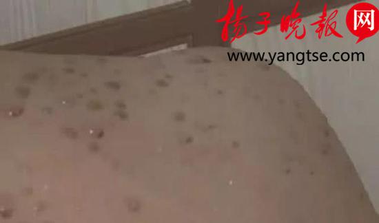浴室淋浴头喷出“泥浆水” 新来的锅炉工操作不当
