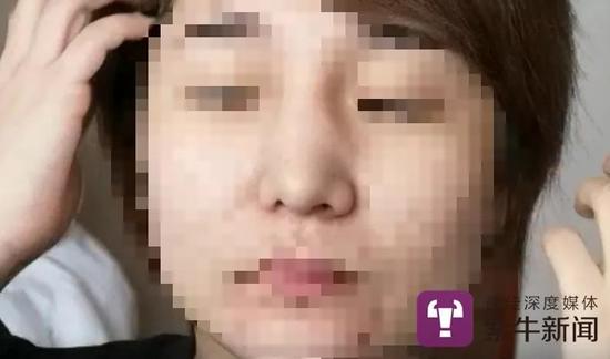 郭琦的鼻子不对称