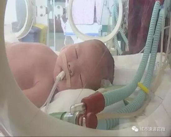 女儿出生后,就住进了新生儿重症监护室,每天郭金钢只能隔着移动门,通过窄窄的门缝多看女儿几眼!