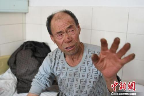 焦先生向记者讲述爆炸当晚的情形。 张瑶摄